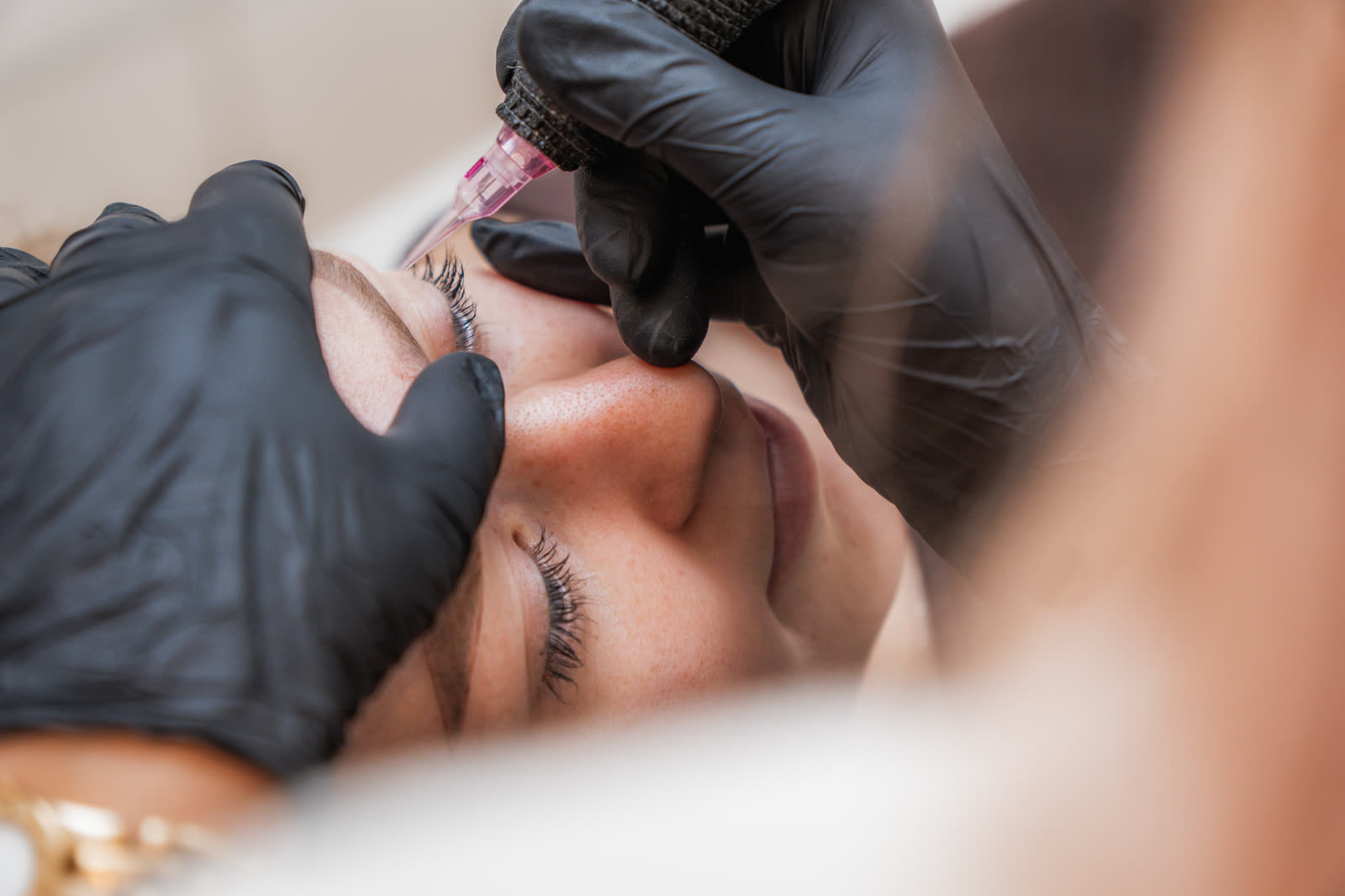 Close-up van een PMU-behandeling